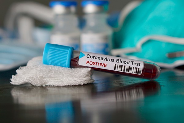 Coronavirus: 259 de persoane internate în spitalele din Constanța