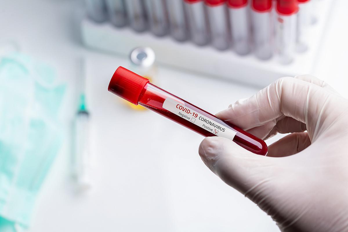 MS: România va recupera, din fonduri europene, banii cheltuiţi pentru decontarea testelor RT-PCR