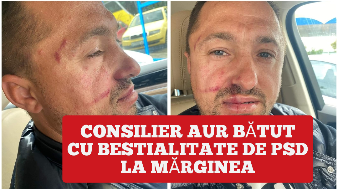 Consilier AUR bătut cu bestialitate de PSD la Mărginea