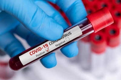 68 de noi infectări cu COVID-19 la Galaţi, în ultimele 24 de ore – Monitorul de Galati – Ziar print si online