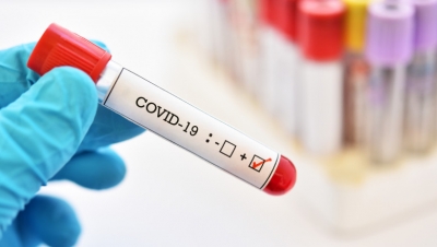 116 cazuri noi de infectare cu COVID-19 la Galați, în ultimele 24 de ore – Monitorul de Galati – Ziar print si online