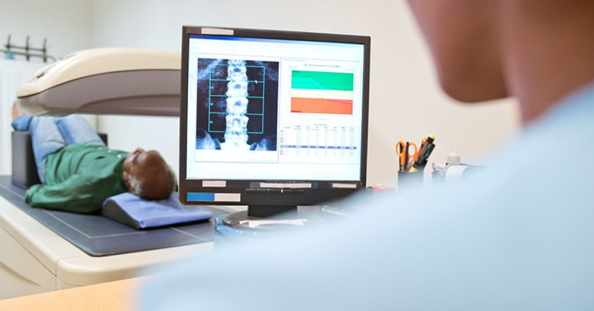 De ce trebuie diagnosticată precoce osteoporoza?
