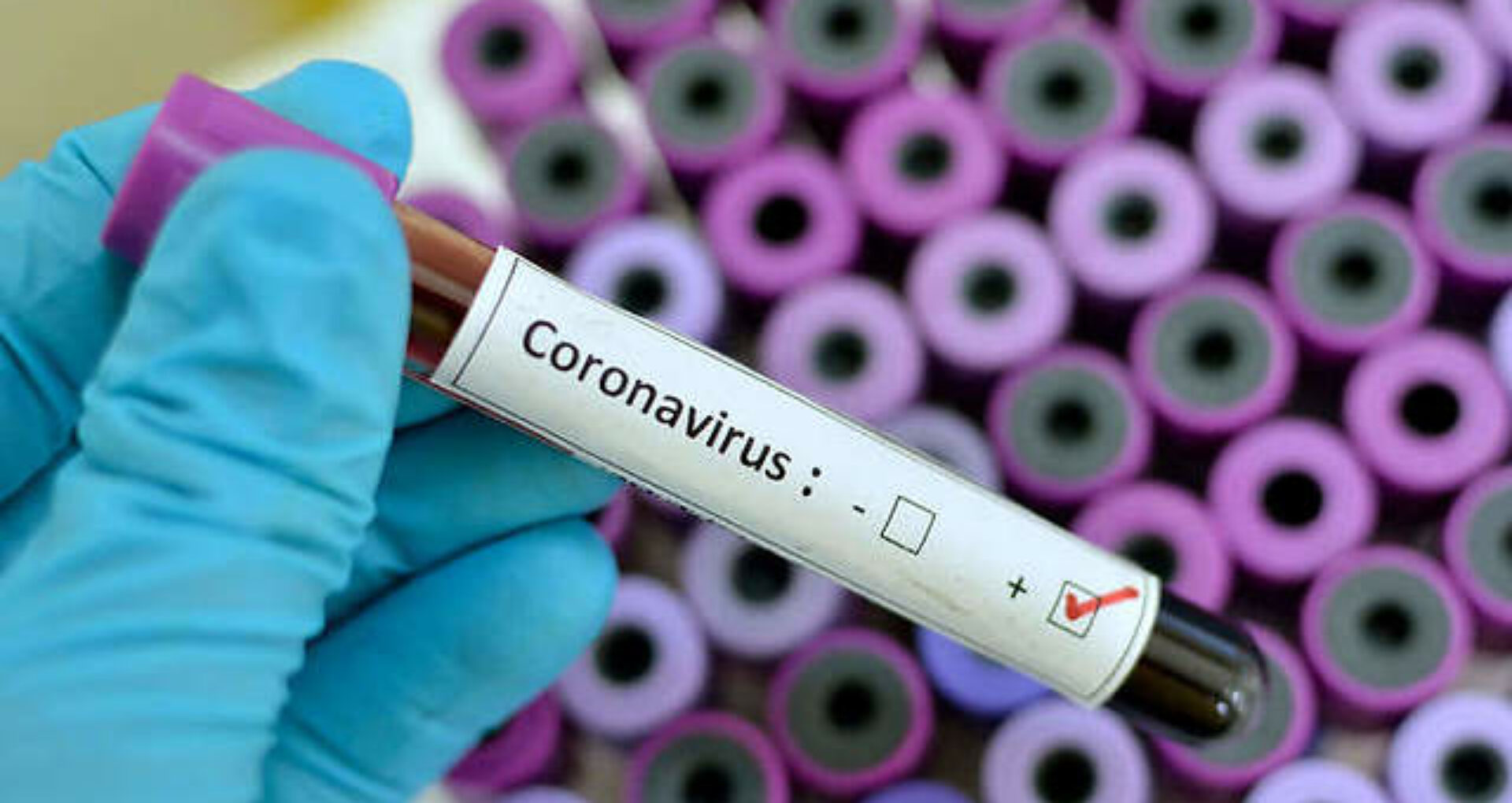 Alte 7 decese din cauza coronavirusului în județul Gorj – GAZETA de SUD