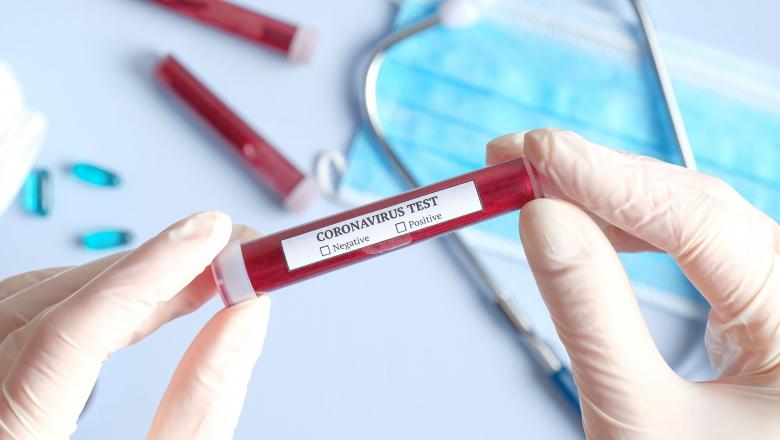 Gorj: Trei noi decese din cauza coronavirusului – GAZETA de SUD