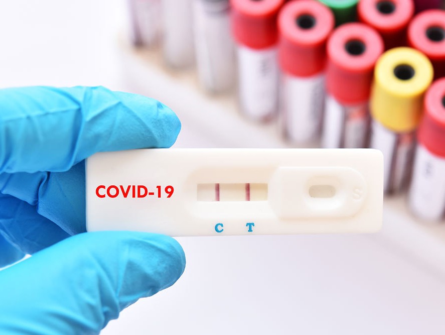 Covid-19. Situația epidemiologică din Dolj, în ultimele 24 de ore – GdS