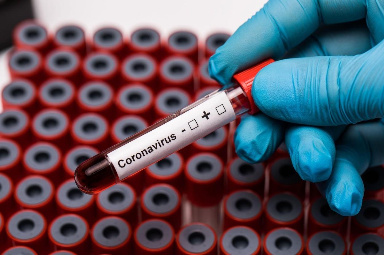 Un deces și 86 de cazuri noi de coronavirus în județul Gorj